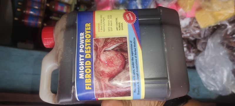 Fibroid destroyer