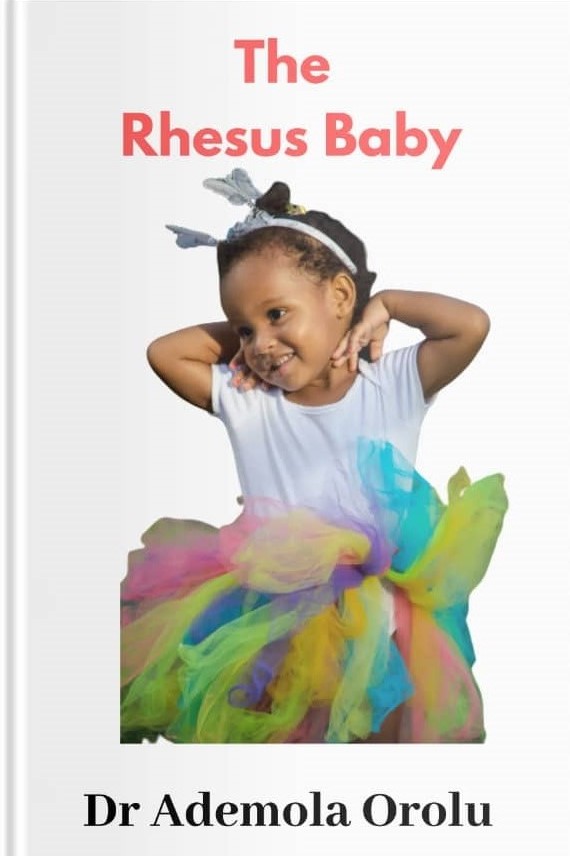 The Rhesus Baby