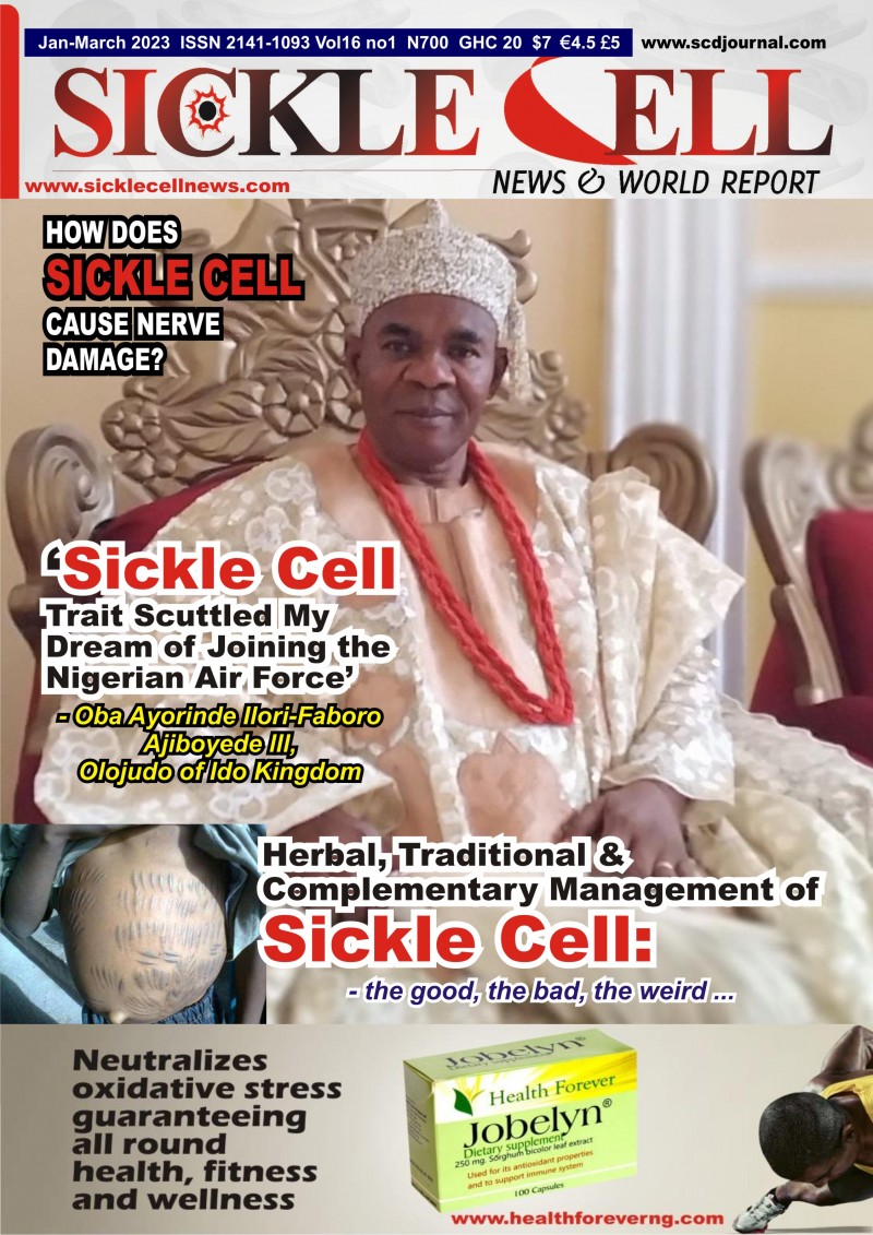 61 Sickle Cell News