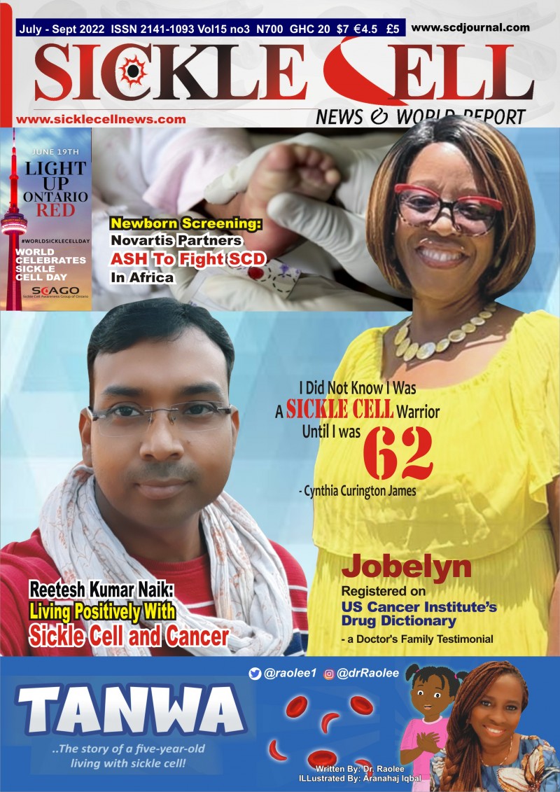 59 Sickle Cell News