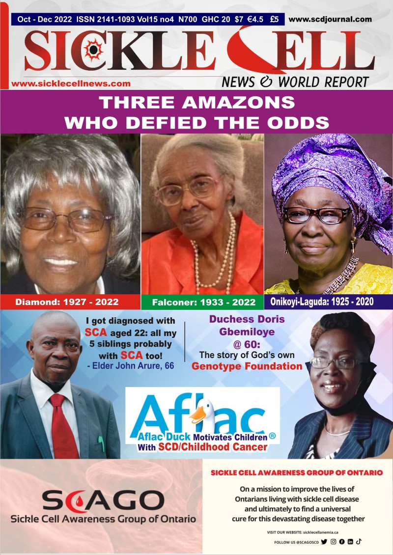 60 Sickle Cell News