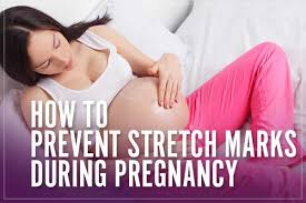 Stretch Marks Removal Cream