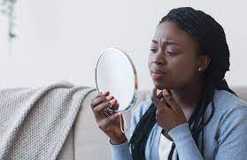 Acne Counselling and Care