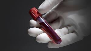 STD Screening