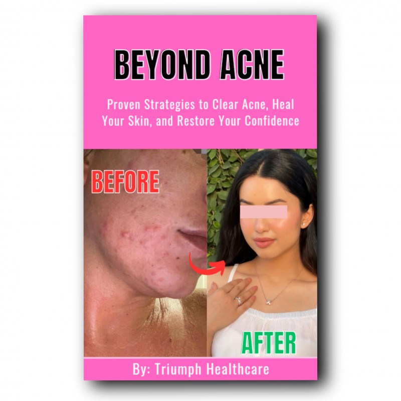 Beyond Acne: Proven Strategies to Clear Acne, Heal Your Skin, and Restore Your Confidence