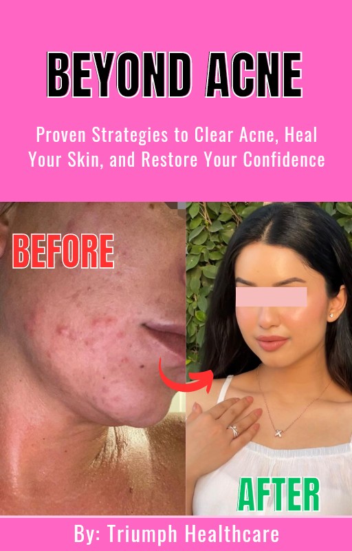 Beyond Acne: Proven Strategies to Clear Acne, Heal Your Skin, and Restore Your Confidence