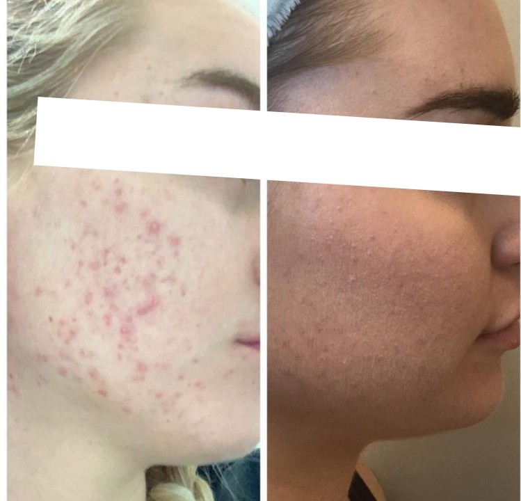 GET GLOWING -- Expert Advice for Clear and Healthy Skin