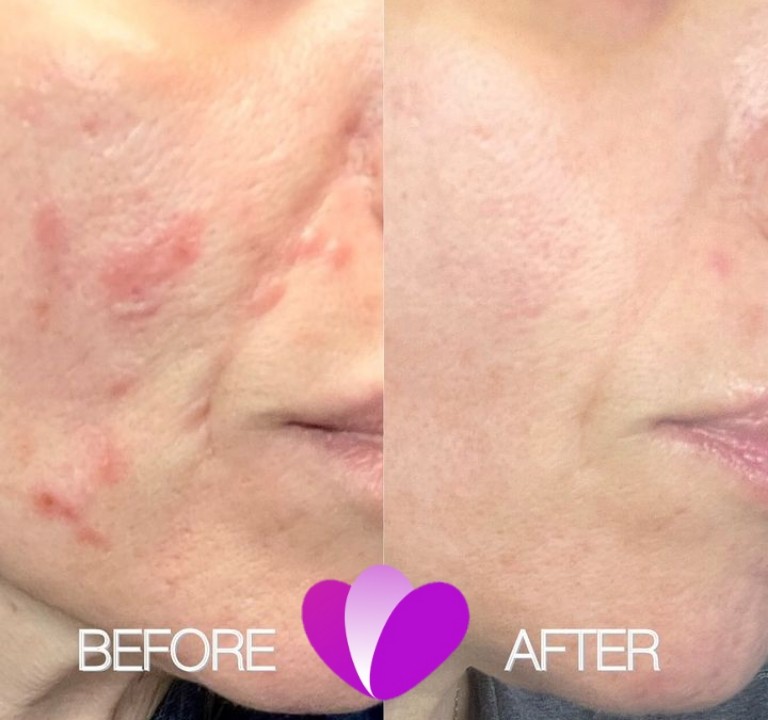 Buy GET GLOWING Expert Advice for Clear and Healthy Skin by Triumph Healthcare on Selar.co