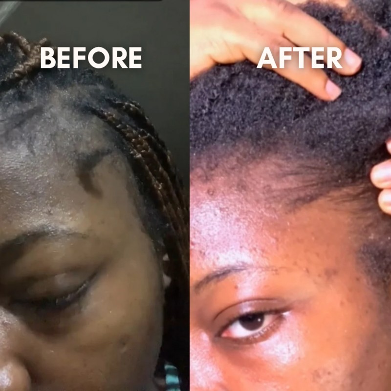 Edges Regrowth Guide