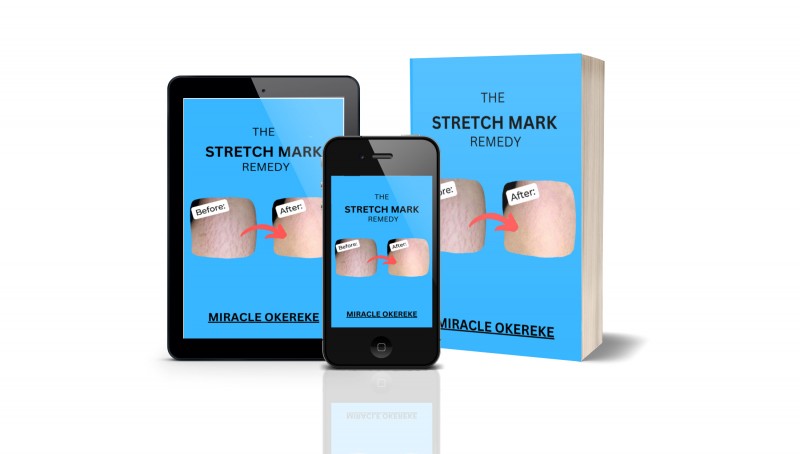 STRETCH MARKS REMEDY