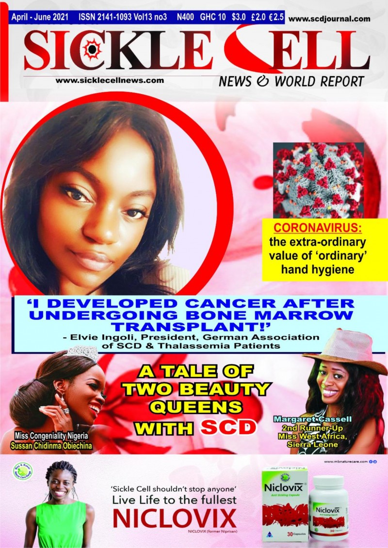 54 Sickle Cell News