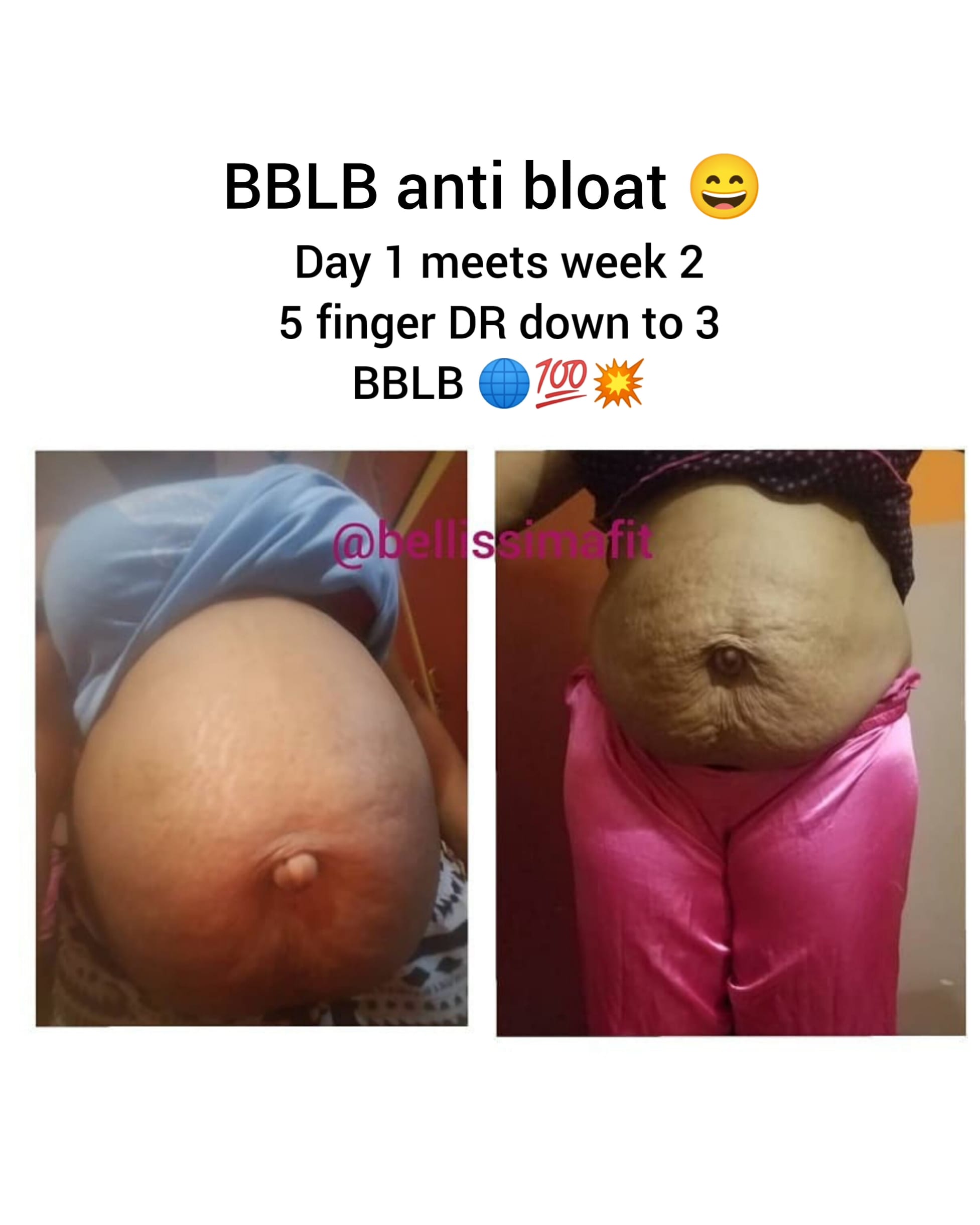 BBLB Pro