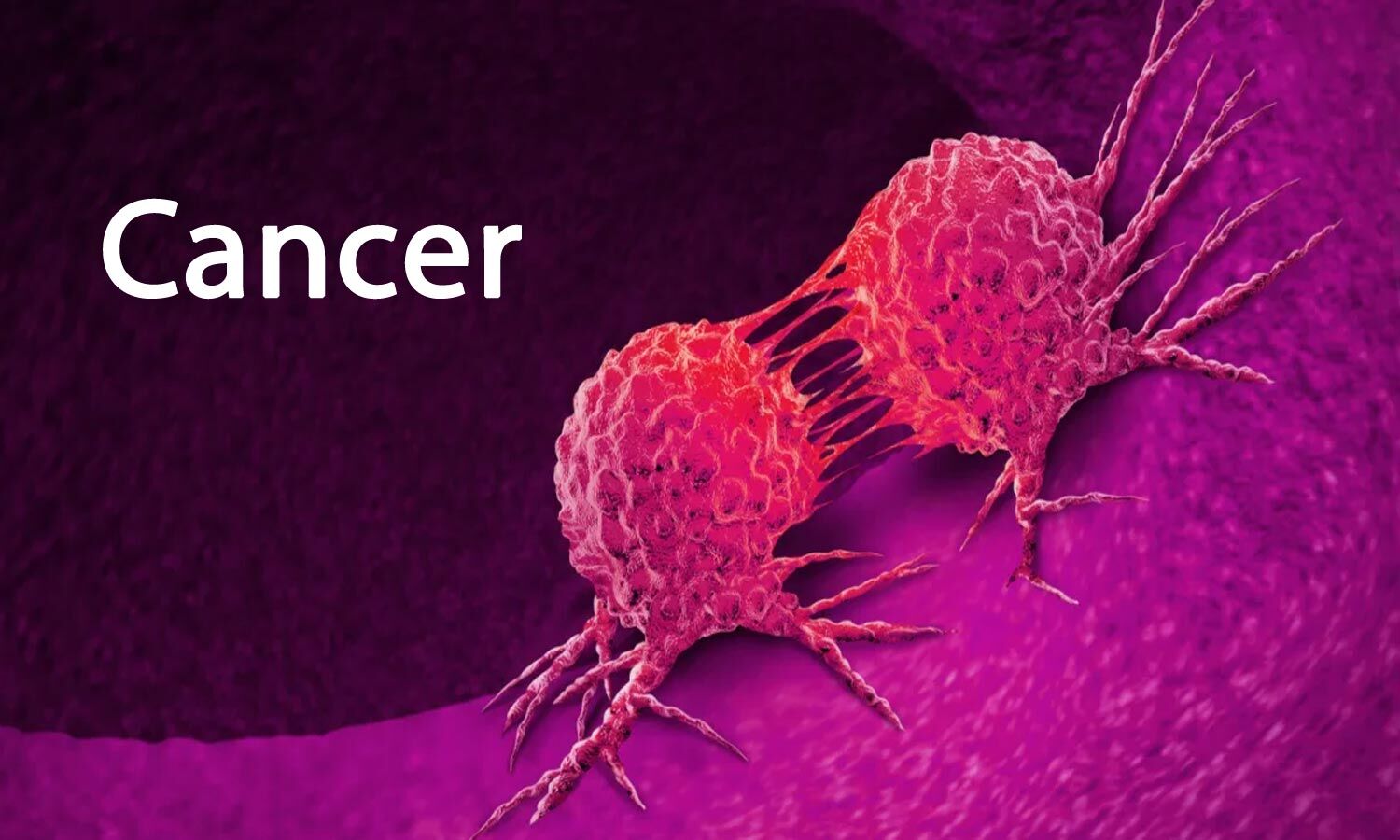 The DEADLY DISEASE called CANCER