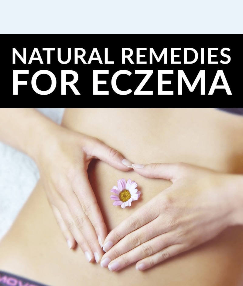 Natural remedies for eczema