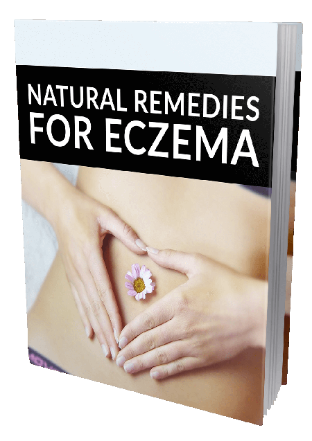 NATUREAL REMEDIES FOR ECZEMA