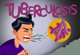 Guide for Prevention, Diagnosis and Treatment of  Tuberculosis in Children and Adolescents