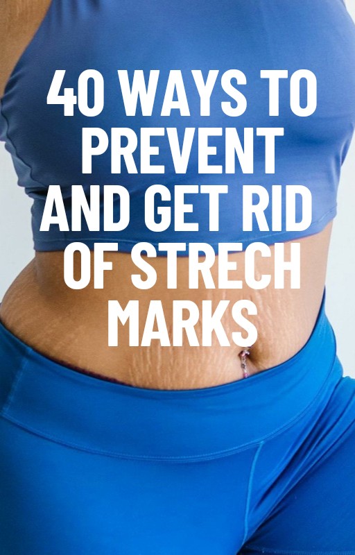 40 Ways To Prevent and Get Rid of Stretch Marks