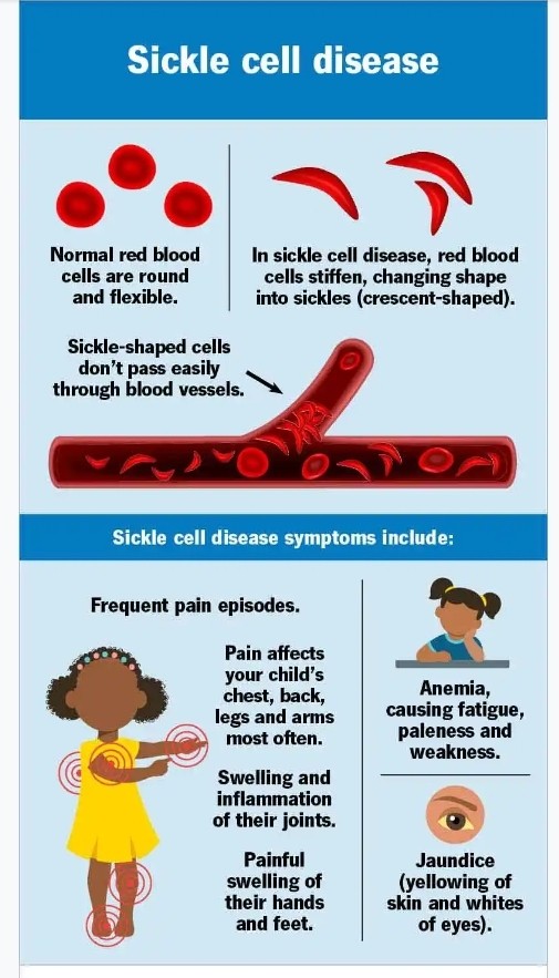 Sickle cell curing guideline book