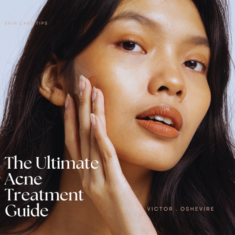 The Ultimate Acne Treatment Guide
