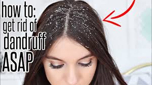 Dandruff Herbal Medicine