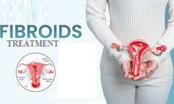 Fibroid Treatment
