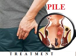 Pile Treatment