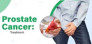 Prostate Cancer