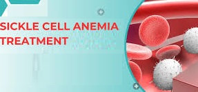 Sickle Cell Treatment