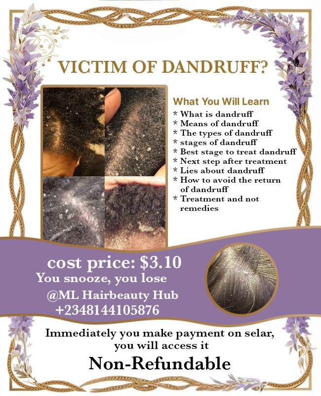Victim of dandruff?