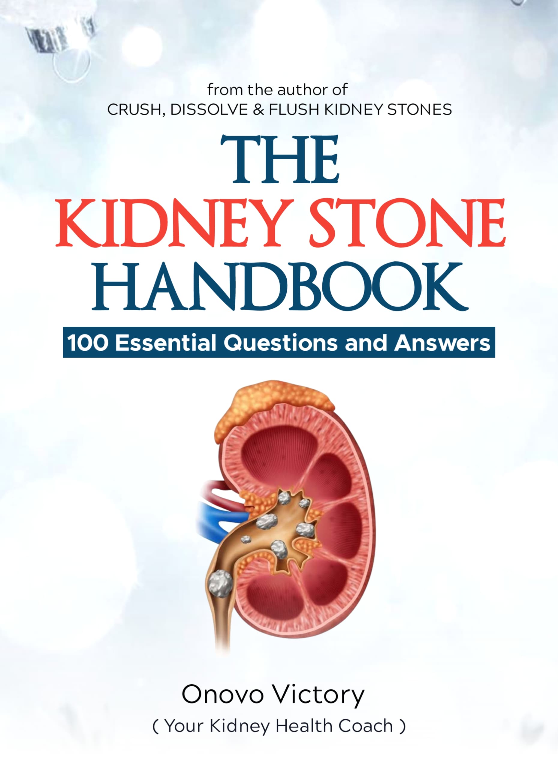 The kidney stone ebook: 100 essential questions and answers