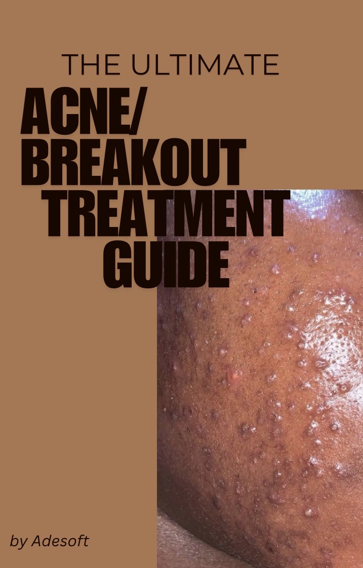The Ultimate Acne/pimples &Dark spot Treatment