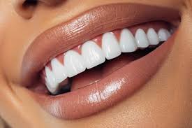 Easy home teeth whitening tips❤️🔥