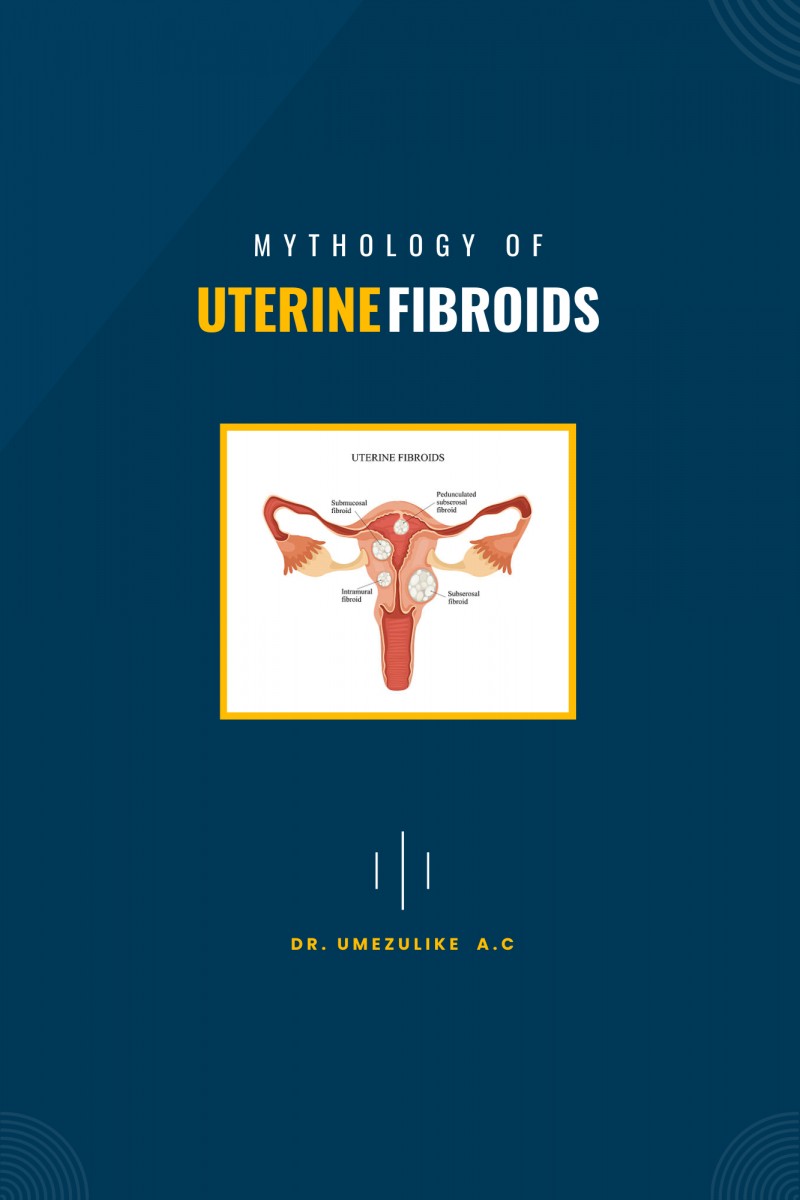 Mythology of Uterine Fibroids