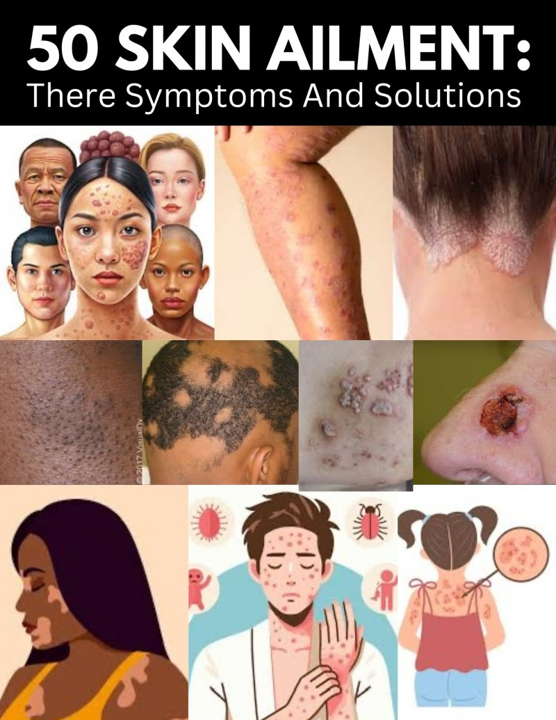 50 SKIN AILMENTS: There Symptoms & Solutions
