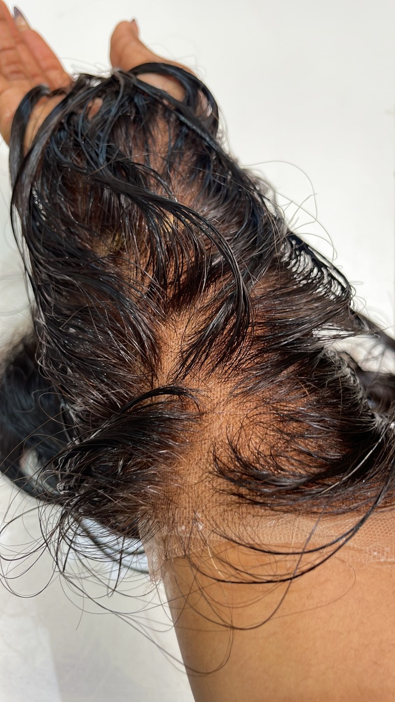 Knot to scalp