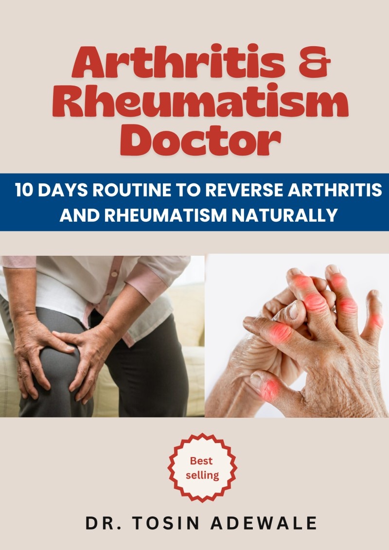 ARTHRITIS AND RHEUMATISM DOCTOR