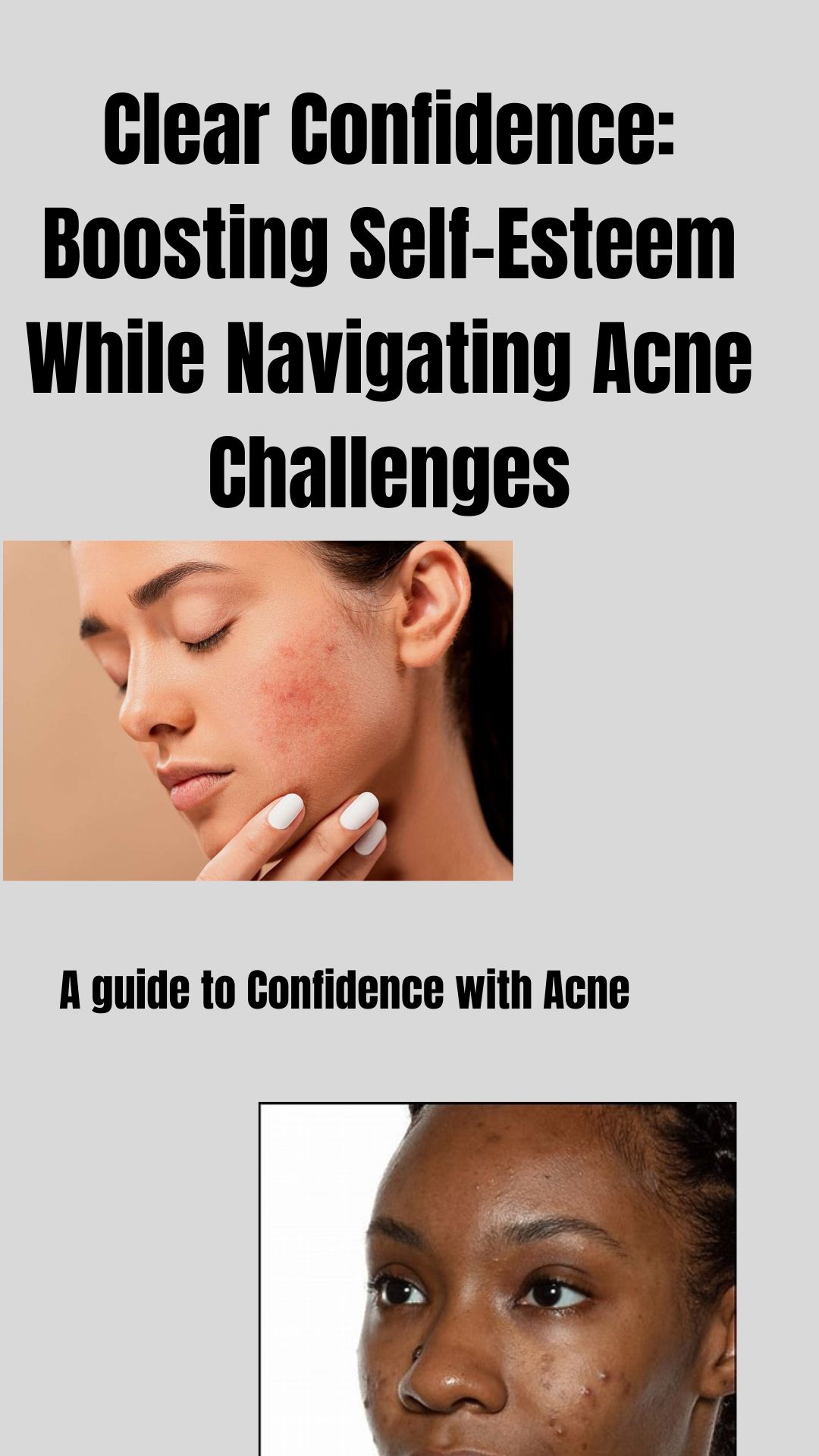 Clear Confidence: Your Guide to Acne and Self-Love
