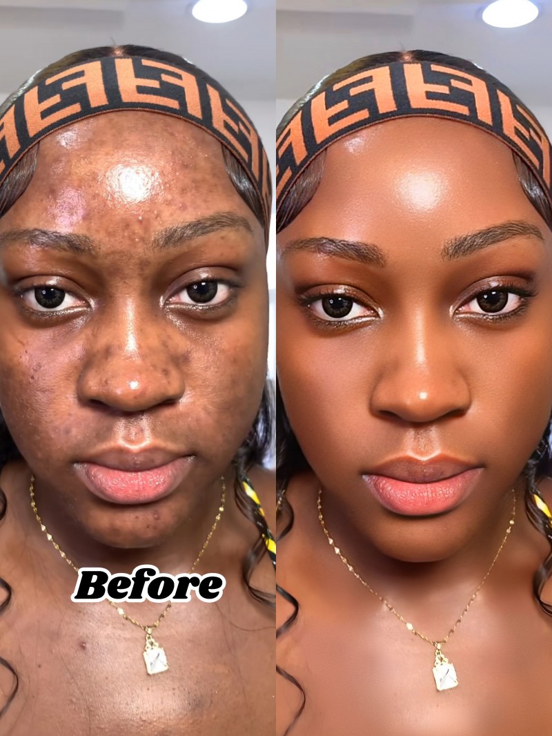 PROFESSIONAL FACE  RETOUCHING C
