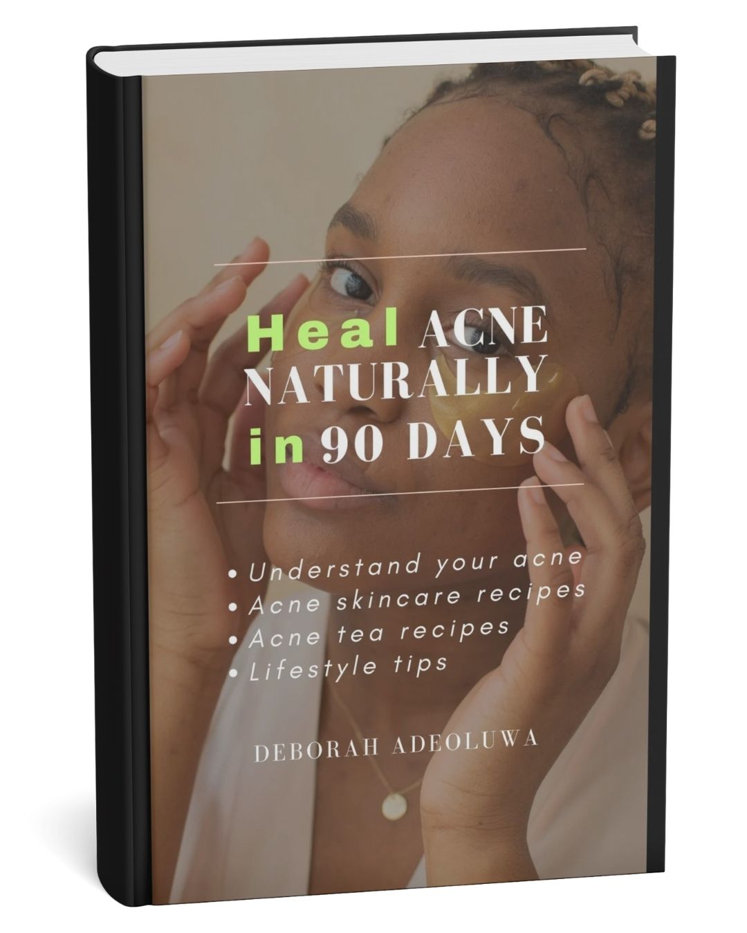 Heal Your Acne Naturally In 90 days