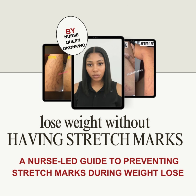 Lose weight without having stretch marks