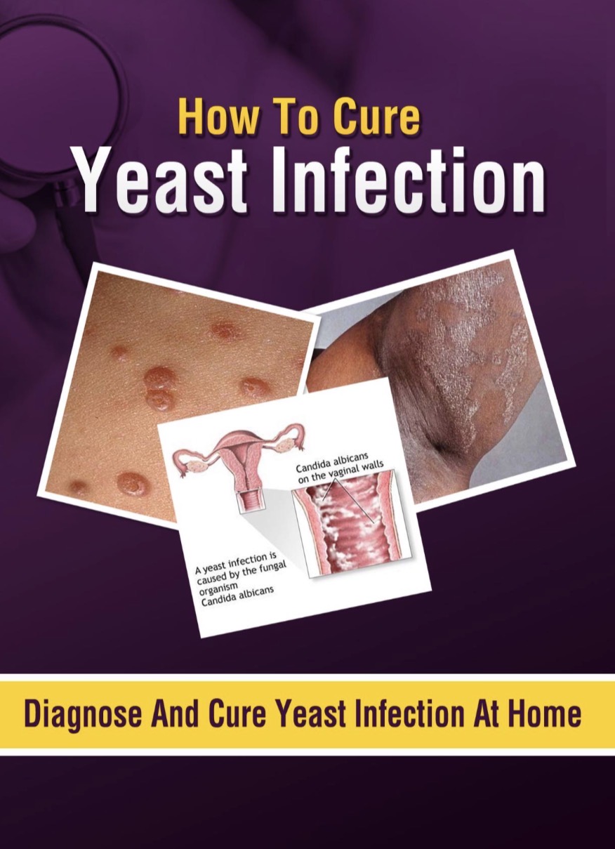 How To Cure Yeast Infection